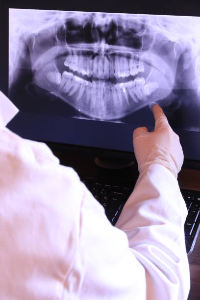 Best Emergency Root Canal Treatment in Gruetli Laager, TN